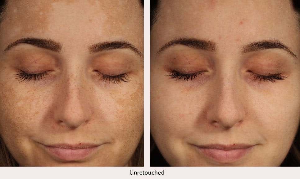Even Pigment Perfector Uneven Skin Tone Eucerin even-pigment-perfector-uneven-skin-tone-eucerin